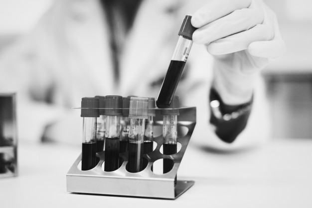 Tüp Bebek Öncesi Yapılması Gereken Testler: Tam Liste